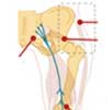 Do you want to know what is causing your back or sciatic pain?